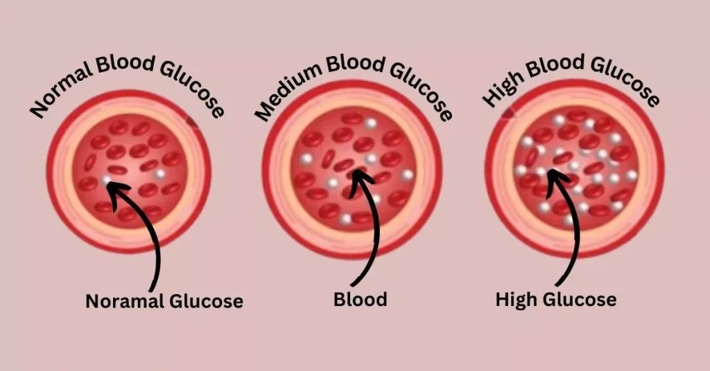 blood sugar diagram 1024x536